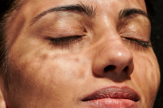 How often should you wash your face?