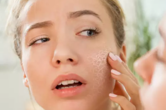 How to tell if you're over-exfoliating your face-LUCEBEAUTY