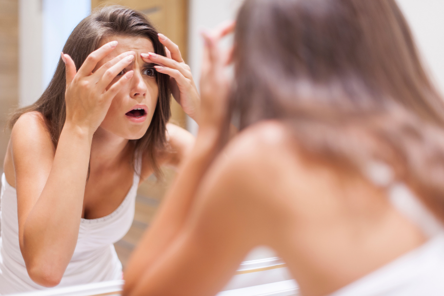 Skin Issues Caused by Coronavirus Lockdown, And How To Deal With Them-LUCEBEAUTY