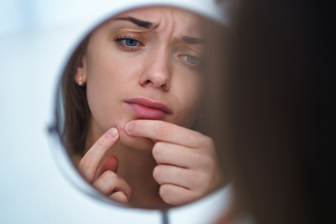 Stress and acne-LUCEBEAUTY